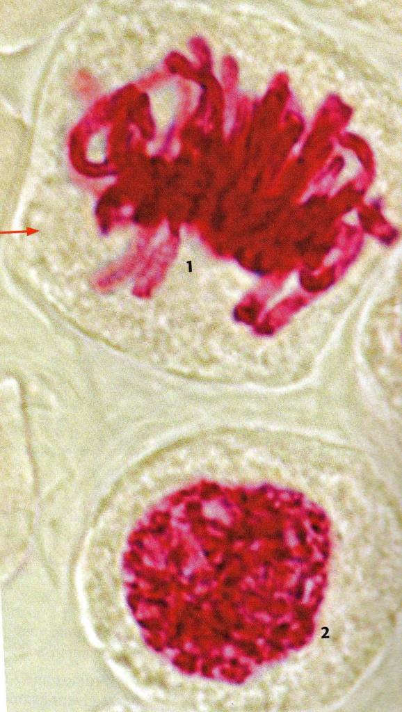TP cellule végétale montrant les chromosomes