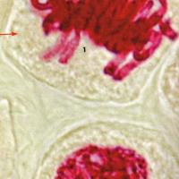 TP cellule végétale montrant les chromosomes