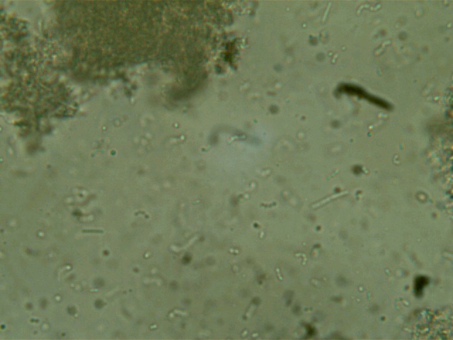 TP Yaourt: découverte des bactéries, microscope x400