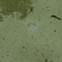 TP Yaourt: découverte des bactéries, microscope x400